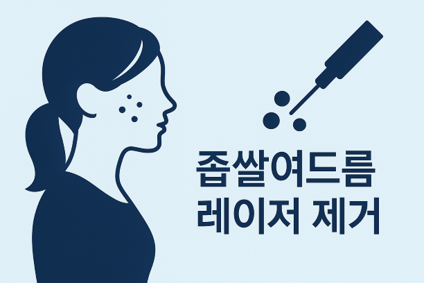 분당 좁쌀여드름 치료 - 레이저 제거
