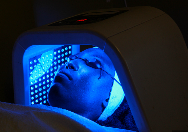 분당 여드름 치료 - PDT