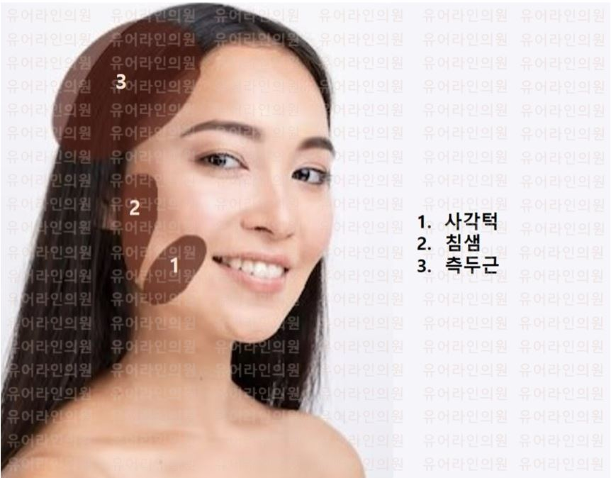 분당 사각턱 · 측두근 · 침샘 보톡스