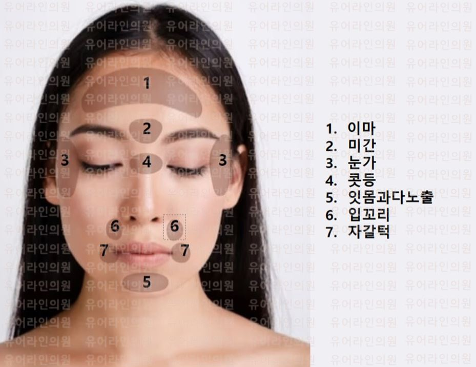 분당 얼굴 주름 보톡스 시술부위