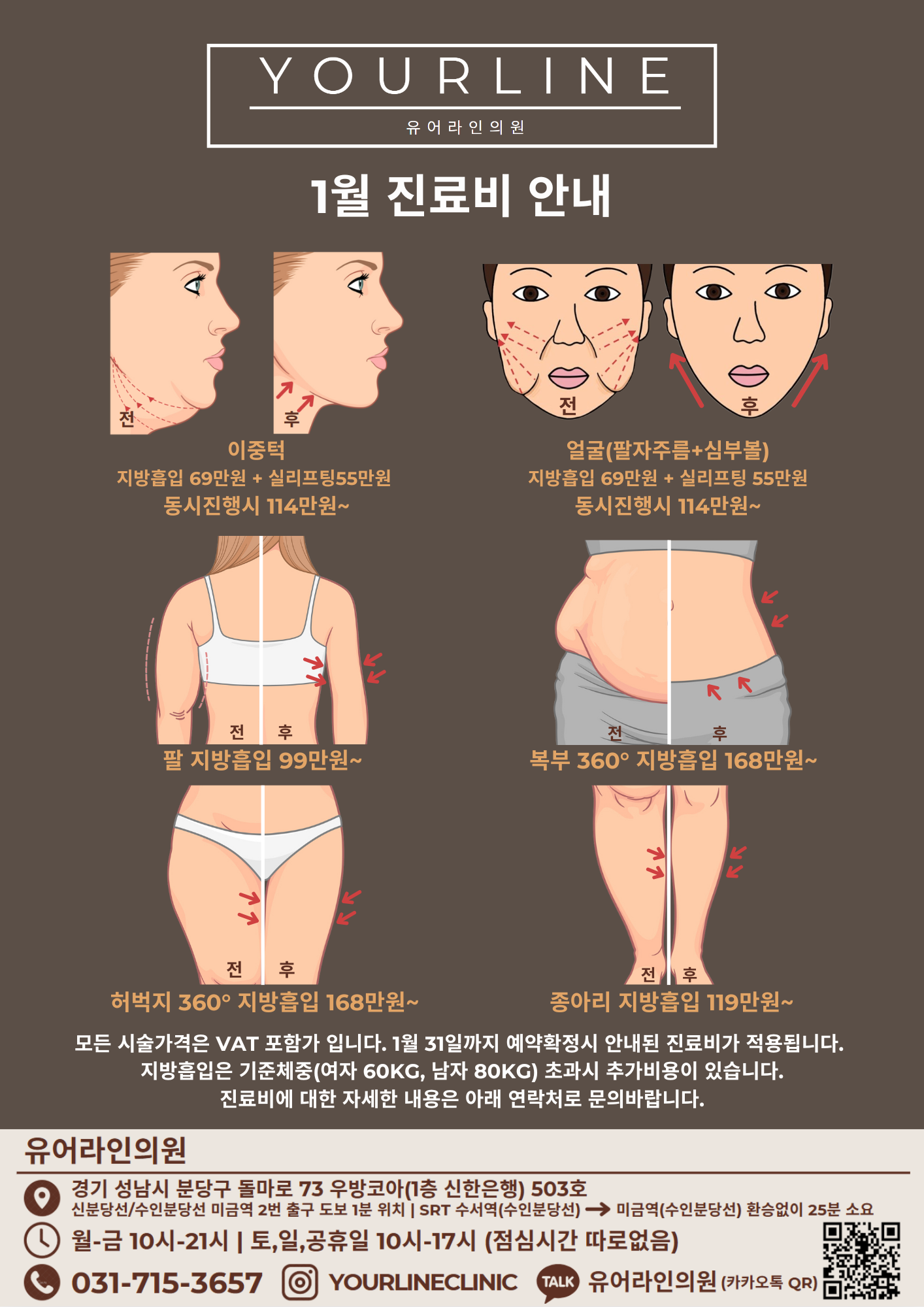 지방흡입 이벤트 가격