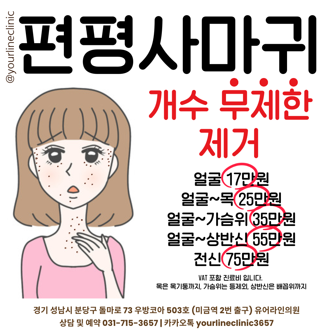 편평사마귀 제거 가격