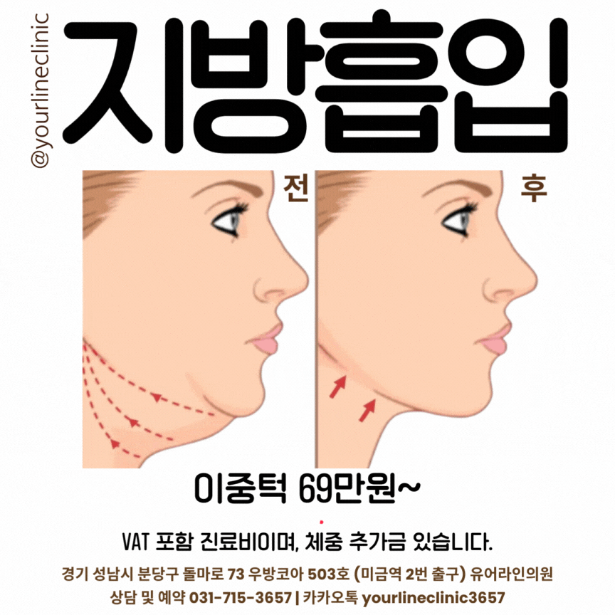 지방흡입 지방추출주사 이벤트 가격